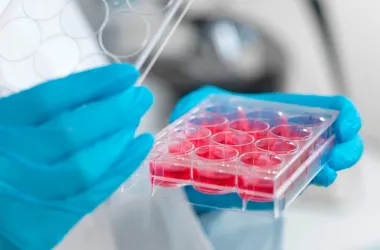 Новый метод лечения инсульта возвращает пациентов к жизни