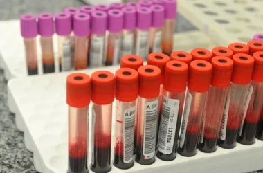 Минздрав  пояснил правила внесения штампа о группе крови в паспорте